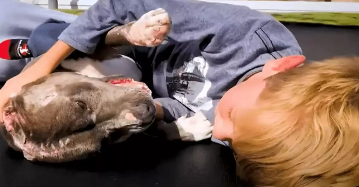 Boy’s Hug for Pit Bull Rescued from Dogfighting Becomes ‘Heart-Melting’ Moment