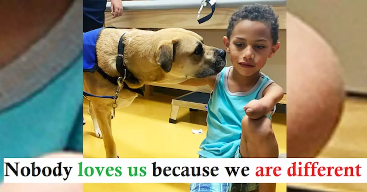 A three-legged dog, once tortured, became a therapy dog and helps children with disabilities